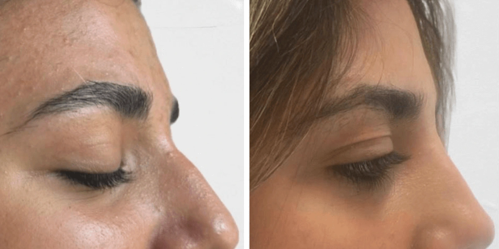 THEA before and after example 7